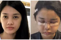 Trình Mỹ Duyên “đập đi làm lại” gương mặt, nhan sắc giờ thế nào?