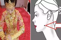 Thần Tài đánh dấu vận son, ai có nốt ruồi ở đây, cả đời phú quý