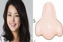 Tướng mũi nhiều người chê nhưng vượng tài lộc, đừng sửa kẻo mất vận sang giàu