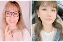 Sau ồn ào bị liệt cơ mặt, Hari Won giờ thế nào?