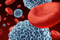 Triển vọng về phương pháp chữa trị bệnh ung thư máu ác tính