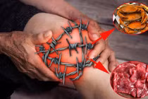 Trời lạnh, bệnh xương khớp cần tuyệt đối tránh 7 thực phẩm này 