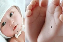 Trẻ có 4 nốt ruồi này trên người cha mẹ tha hồ mừng to