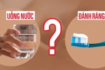 Uống nước trước hay đánh răng trước khi ngủ dậy buổi sáng?