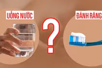 Uống nước trước hay đánh răng trước khi ngủ dậy buổi sáng?