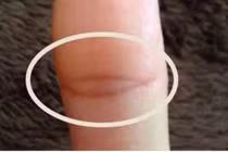 Người có vân tay 'mắt phật' này có duyên với Thần tài