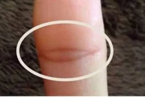 Người có vân tay 'mắt phật' này có duyên với Thần tài