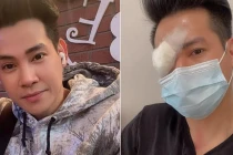 Phùng Ngọc Huy khiến fan lo lắng khi bất ngờ đăng ảnh