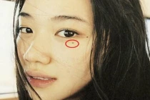 5 nốt ruồi phá tướng, rước thị phi, làm công danh lao đao