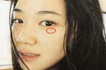 5 nốt ruồi phá tướng, rước thị phi, làm công danh lao đao