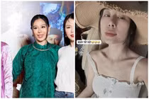 Nam Thư mặt biến dạng, nghi vấn thẩm mỹ hỏng