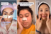 Bác sĩ da liễu cảnh báo về những mẹo chăm sóc da sai lệch trên TikTok