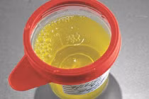 Nam giới thấy có 3 đặc điểm này nghĩa là thận đang rất khỏe mạnh