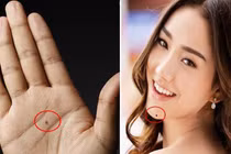 5 nốt ruồi ẩn chứa tài lộc, ai sở hữu sướng như "bắt được vàng"