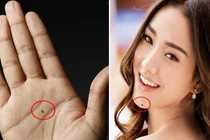 5 nốt ruồi ẩn chứa tài lộc, ai sở hữu sướng như "bắt được vàng"