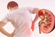 Triệu chứng suy thận sớm cần đặc biệt chú ý