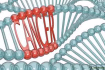 Video: 5 dấu hiệu chính xác cảnh báo sớm ung thư trực tràng