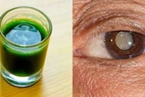 Video: Mắt mờ nhìn không rõ sẽ sáng lại chỉ bằng cách đơn giản này