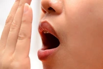 Video: Nguyên nhân hôi miệng chữa mãi không khỏi