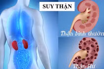 Video: Làm ngay 4 điều này để phòng bệnh thận