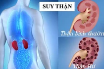 Video: Làm ngay 4 điều này để phòng bệnh thận