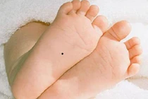 Video: Sinh con có 3 nốt ruồi hiếm, cha mẹ ngồi chơi cũng có tiền