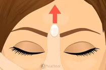 Video: Day vào trán có thực sự chữa được đau đầu?