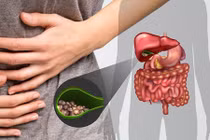 Video: Cắt túi mật ảnh hưởng thế nào đến sức khỏe của bạn?