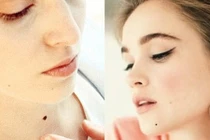 Video: Chỉ cần xóa nốt ruồi này tài lộc đầy nhà, giàu sang ập tới