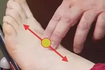 Video: 5 giải pháp giúp bạn tự cứu mình khỏi bệnh tắc mạch máu