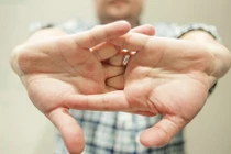 Video: Bẻ khớp tay, triệu chứng của rối loạn thần kinh?