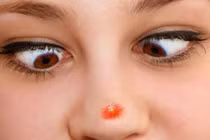 Video: Mụn mọc vị trí này, chắc chắn 100% đang có bệnh nặng