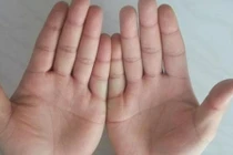 Video: Có dấu hiệu này trên bàn tay, đang nghèo bỗng giàu lên chóng mặt 