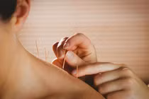 Video: 6 sự thật về châm cứu có thể bạn chưa biết?