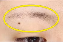 Video: Trên mặt có dấu hiệu này, có thể trong người đang có trọng bệnh