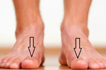 Video: 7 dấu hiệu bất thường ở chân cảnh báo sức khoẻ nguy hiểm