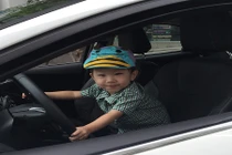 BV Vinmec mổ thành công ca giãn tĩnh mạch hiếm gặp