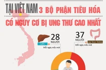 Cảnh giác cao độ với ung thư đường tiêu hóa dịp cuối năm 