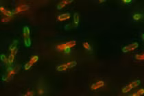 Vì sao vi khuẩn cố tình "la hét" thất thanh trước khi chết? 