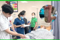 Đắp lá ngải nóng để phục hồi chức năng, người đàn ông bị bỏng độ 3