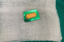 Viên thuốc còn nguyên vỏ sắc nhọn trong thực quản bệnh nhân 33 tuổi