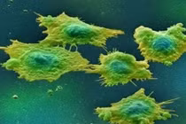 3 loại thực phẩm giàu tính kiềm là thiên địch của ung thư