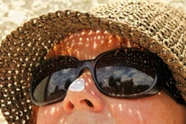 Tuyệt chiêu tránh nám da hiệu quả vào mùa hè