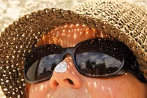 Tuyệt chiêu tránh nám da hiệu quả vào mùa hè