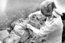 Điều trị ung thư tế bào thận