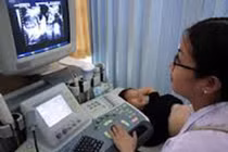 Phát hiện ung thư cổ tử cung sớm