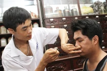 Bài thuốc hỗ trợ điều trị chứng liệt mặt