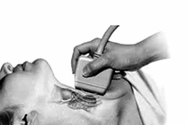 Tại sao phụ nữ hay bị bướu tuyến giáp?