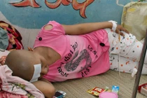 Nhận biết ung thư ở trẻ em