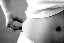 Làm đẹp vòng 2 dễ bị thuyên tắc động mạch phổi